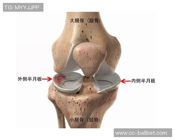小卡34岁迎生涯首个50分表现ACL部分撕裂与半月板损伤影响膝盖健康